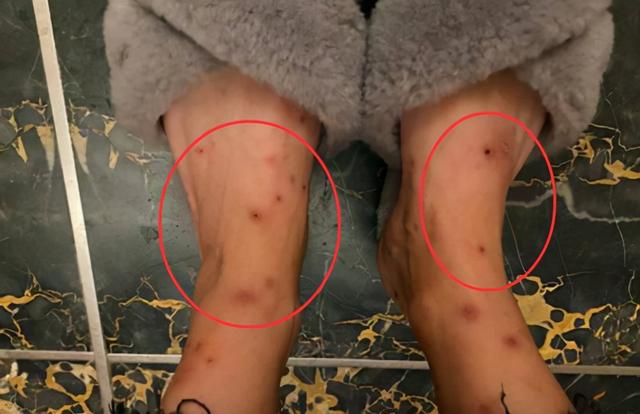 恐龙时代的跳蚤有多大，恐龙的时代有几个纪（1.5亿年前曾在恐龙身上吸血）