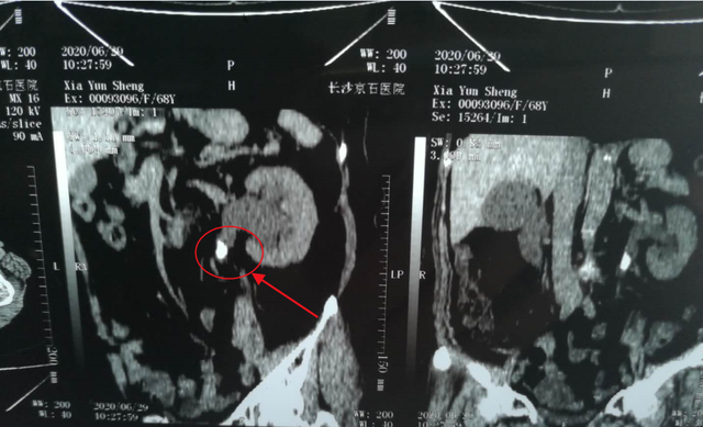 雀神是什么意思，雀神是什么意思（“雀神”娭毑一上牌桌就不喝水）