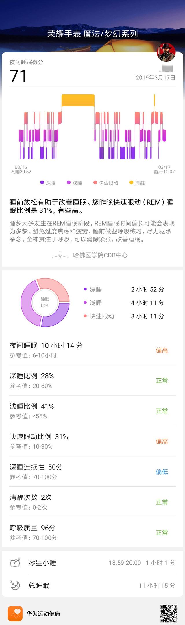 简笔画手表画法，手表简笔画 简图（荣耀手表100天深度体验）