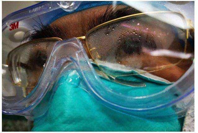 怎么防止眼镜起雾，怎么防止眼镜起雾气（九种方法防止护目镜起水雾）