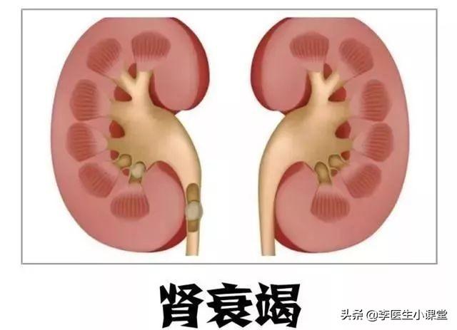 老人补钙吃什么食物最好最快，老年人补钙吃什么食物（补钙强肾预防骨关节炎）