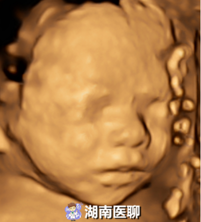 一维条码有什么用，孕检中除了二维、三维