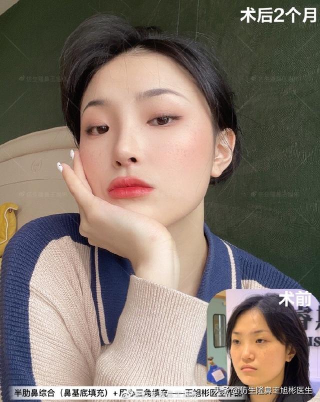 高级脸是什么意思，6种脸型不显老（“月亮脸”逆袭“高级脸”的不二法则是）