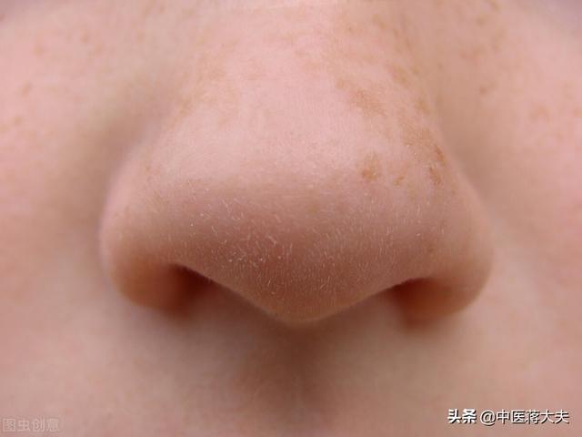 鼻子出血是什么原因，鼻子出血是什么原因引起的老年人（看完这篇文章后，你就知道了）