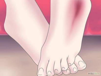 变向是什么意思，xxs是什么意思（每个跑友都应该看一看的崴脚知识）