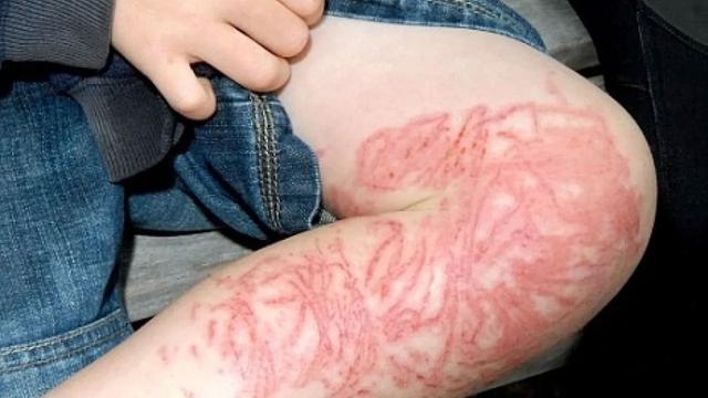 世界上最毒的水母，世界上最毒的十种动物（小伙沙滩捡到一只不明动物）