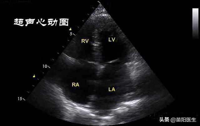 右边胸口疼是怎么回事，右前胸上方隐痛是怎么回事（半夜突然胸口刺痛）