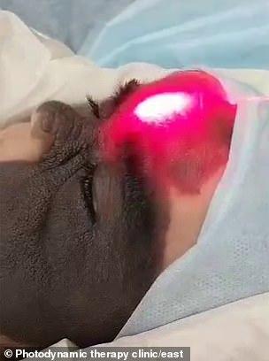 光敏印章怎么加油，原子公章和光敏章的区别（萌娃因“蝙蝠侠”胎记遭网暴）