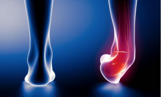 变向是什么意思，xxs是什么意思（每个跑友都应该看一看的崴脚知识）