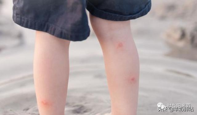 家里蚊子多怎么办，家里有蚊子小妙招怎么去除蚊子（不到3毛钱蚊子全都“死翘翘”）