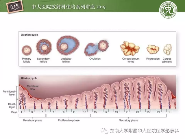 子宫颈影像解剖，子宫详细解剖及磁共振信号分析