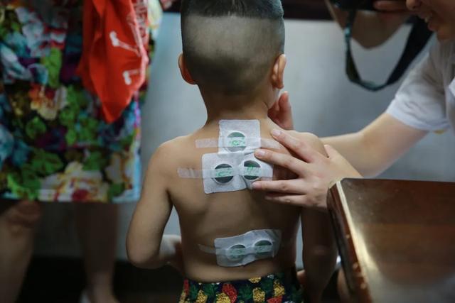 2020年二伏是几号  哪天是二伏2020，2020年二伏是几号（三伏将至，冬病夏治正当时）