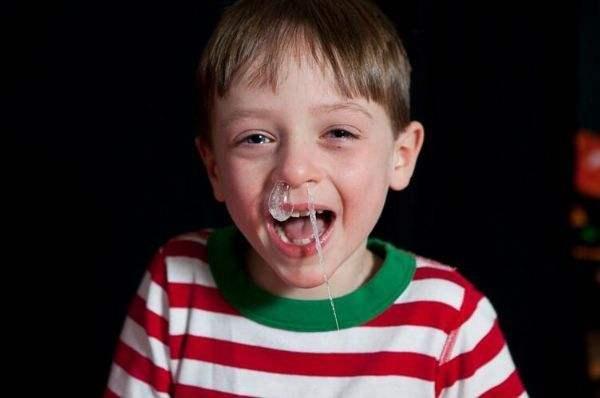 宝宝总是流鼻涕怎么办，宝宝鼻子总是流鼻涕怎么办（宝宝流鼻涕不一定就是感冒）