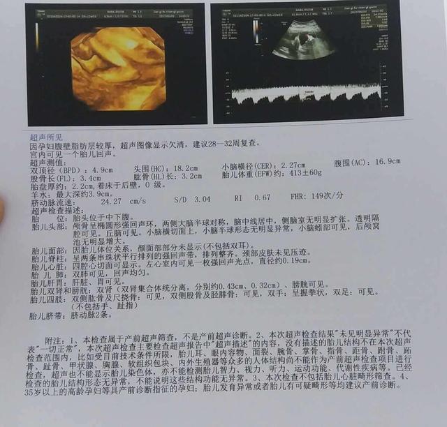 10分钟看懂四维，检查报告的这几点能看懂
