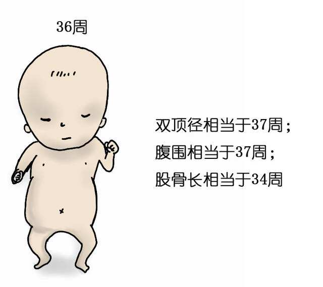 孕37周双顶径标准(医生说胎儿股骨长偏短) - 乐宝宝贝