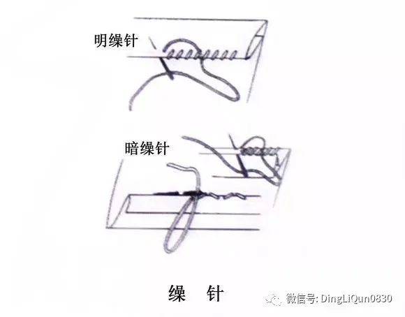 衣服开线了用倒回针法怎么缝，缝衣服倒回针针法（手工缝纫衣物20种常见针法）