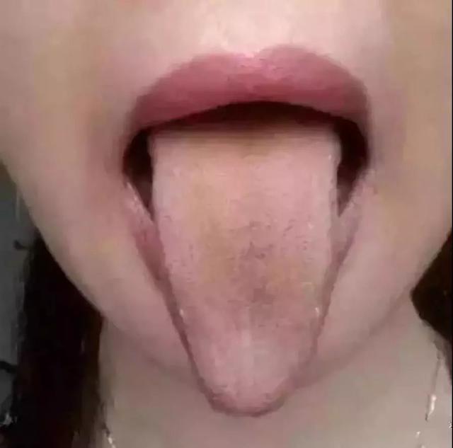 健康的舌头图片，如何判断自己的舌头健康状况（五脏在舌头均有反射区）
