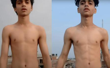 跳绳2000个消耗多少卡路里，跳绳消耗多少卡路里（外国小伙每天跳绳2000下）