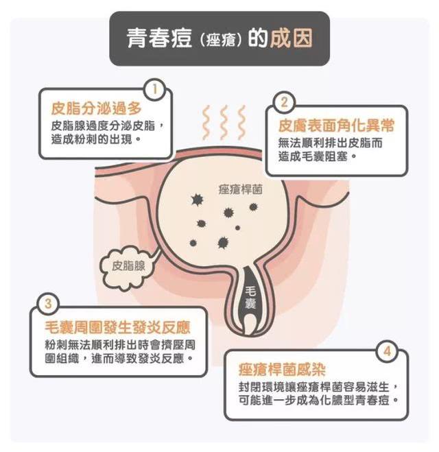 凝胶排出物对照图片，苦参凝胶排出物图（<痤疮>的成因、护理与治疗方法）