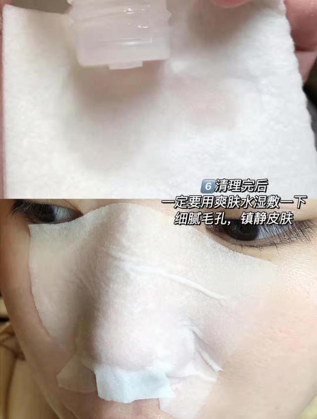 去黑头收缩毛孔，怎样去黑头和收缩毛孔（去黑头收缩毛孔的最好方法）