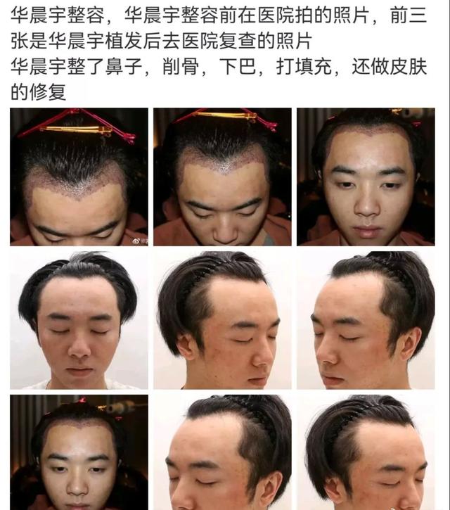 反转太快！全面梳理华晨宇事件始末，谈谈花花团队的公关能力