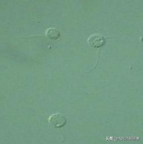 微生物镜检标准是多少，污水处理厂微生物镜检流程与污泥活性分析总结