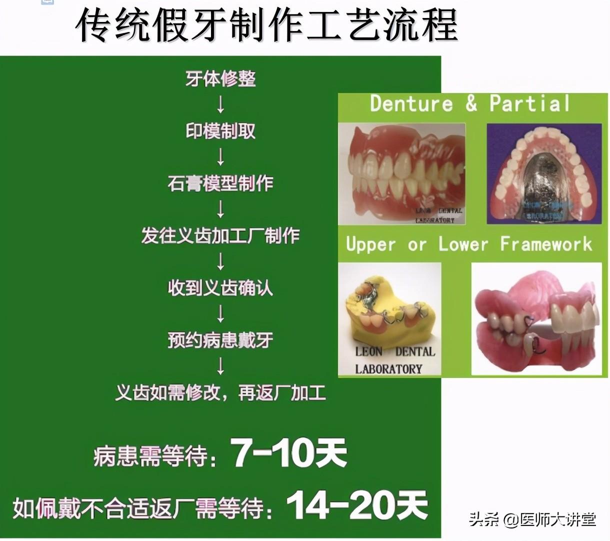 义齿加工（假牙制作新方法）