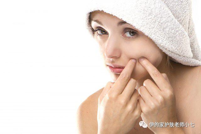 去除闭合性粉刺小妙招，闭合性粉刺如何治粉刺怎么去除小妙招用什么有效（脸上闭合粉刺怎么去除）