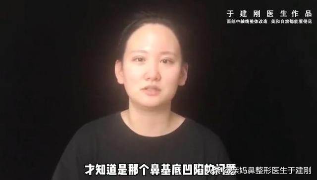 一张图看懂鼻基底凹陷对比图，塌鼻秒变立体质感鼻