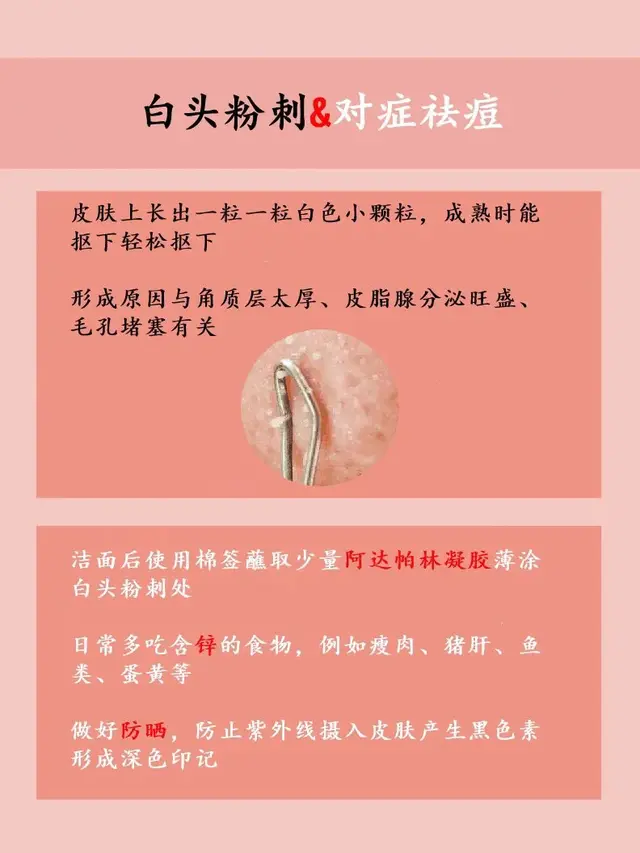 碘伏可以涂在脸上的痘痘吗，碘伏消毒液可以涂脸上痘痘吗（5种不同类型得痘痘）