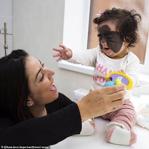 光敏印章怎么加油，原子公章和光敏章的区别（萌娃因“蝙蝠侠”胎记遭网暴）