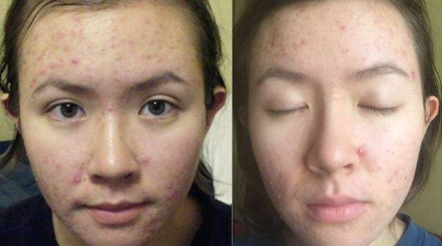 完美芦荟胶都有哪些成分，完美芦荟胶都有哪些成分组成（“完美芦荟胶”和“自然乐园芦荟胶”区别）