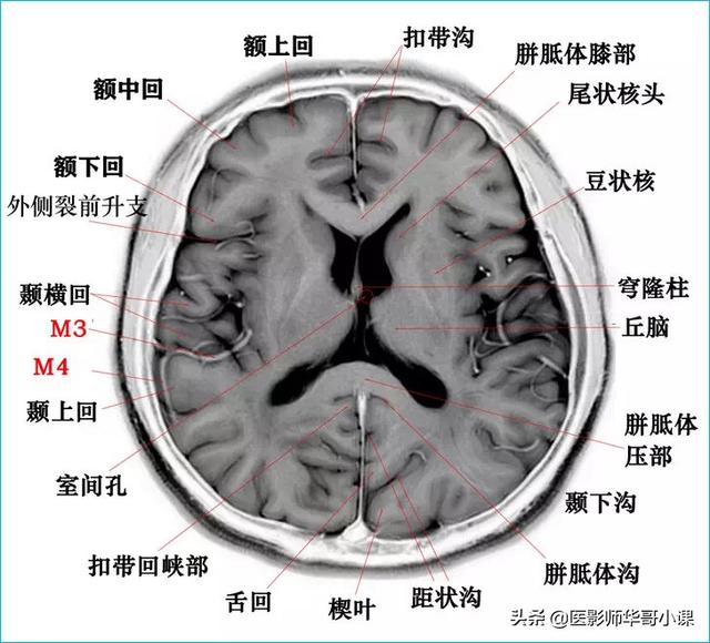脑干位于头部哪个位置图片