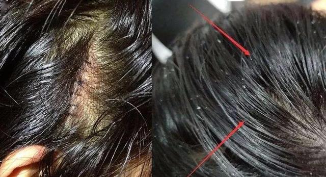 头发出油是什么原因导致的，头发出油是什么原因（这些原因不能忽视）