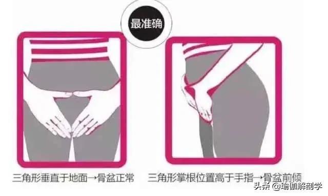 骨盆前倾最快纠正法，骨盆前倾能矫正过来吗（10个瑜伽理疗动作）