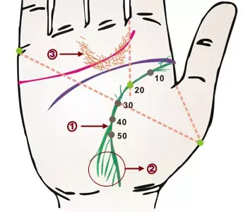 掌纹诊病实用图谱，看看你的掌纹：预示者不同疾病（可以诊断肝癌、糖尿病、高血压、妇科病、脑溢血）