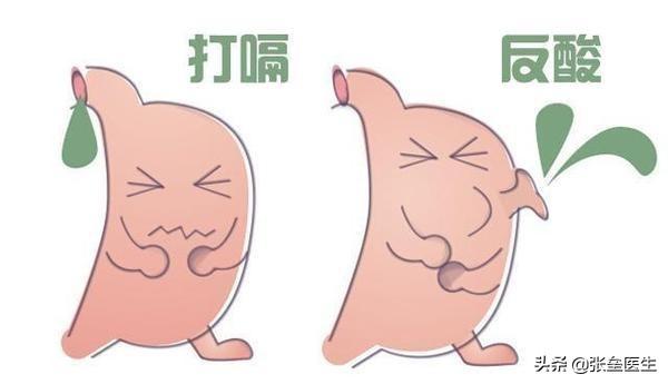 一直打嗝是什么原因引起的，总爱打嗝是什么原因引起的（先看看这四点原因你占了几样）