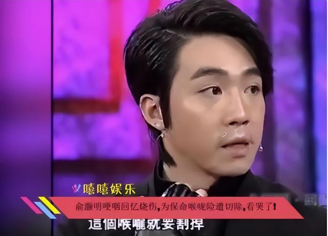 俞灏明毁容前和毁容后，再到摘掉“糊咖”的帽子