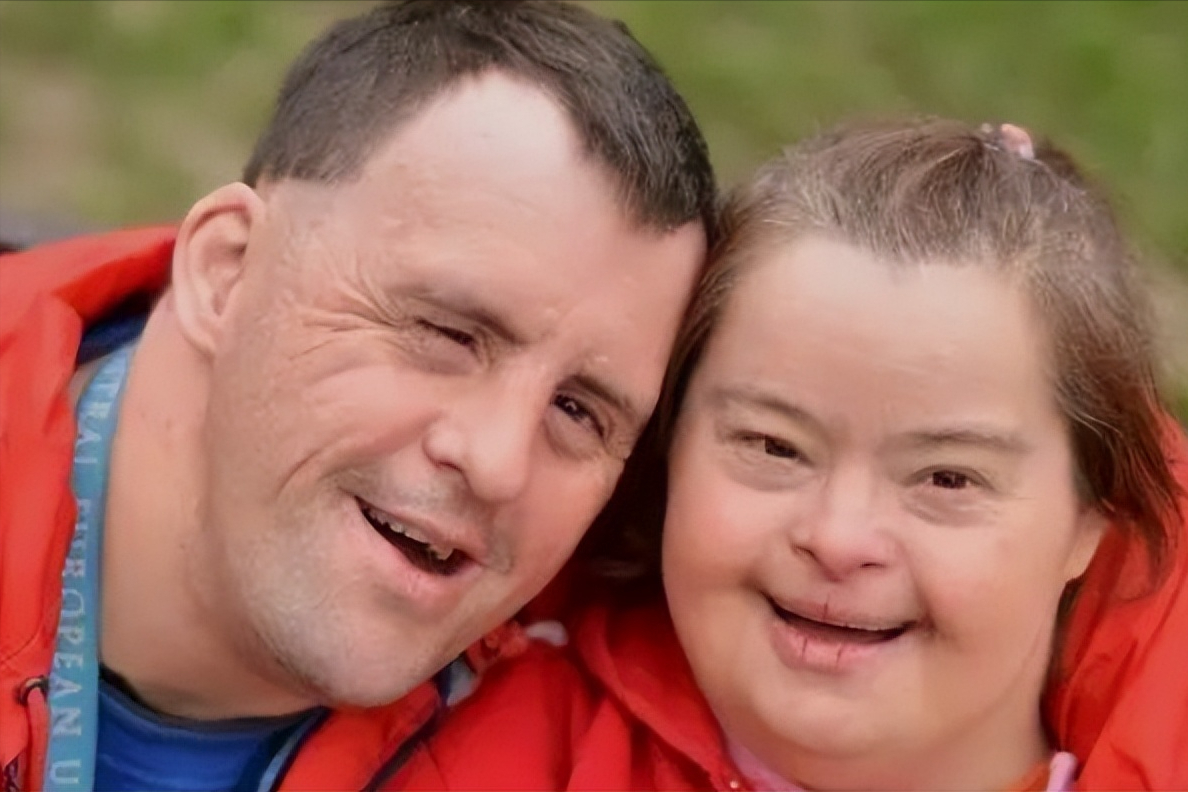 什么是唐氏综合症?