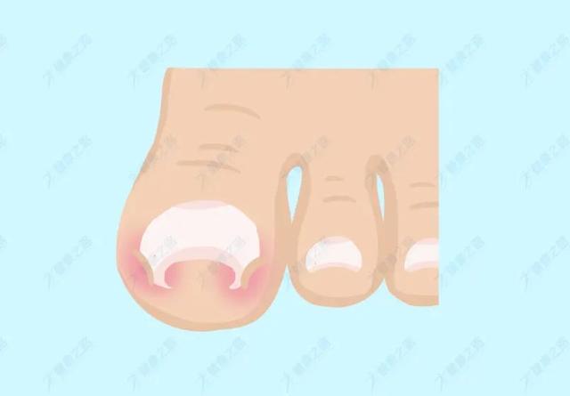 如何使用指甲剪修剪指甲，指甲应该怎么修剪（你可能都用错了方法）