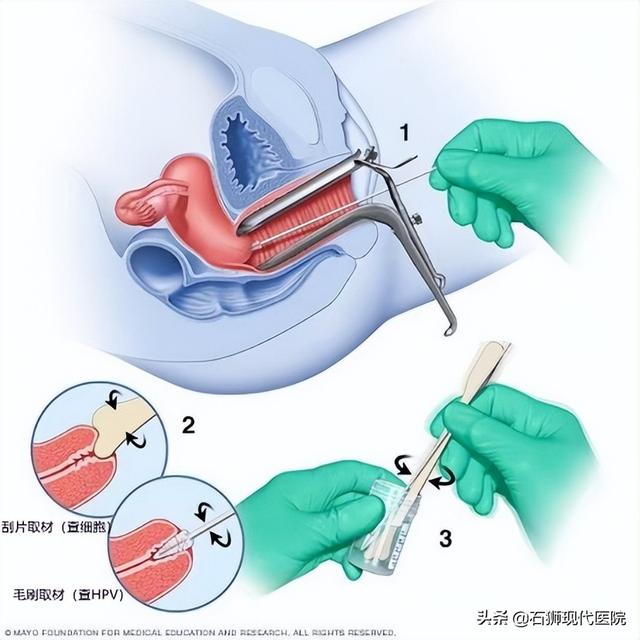 b型血的女性非常受欢迎(妇科体检查哪些最全指南来了)