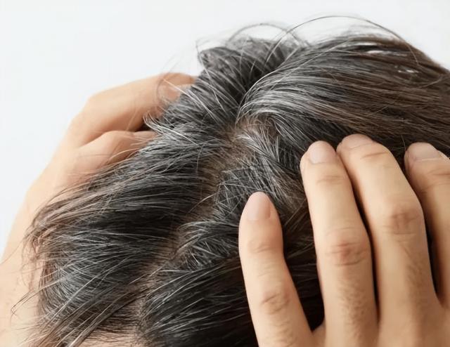 人的头发有各种各样的颜色是什么原因造成的，人的头发的颜色是由什么决定的（导致白发的原因有哪些呢）