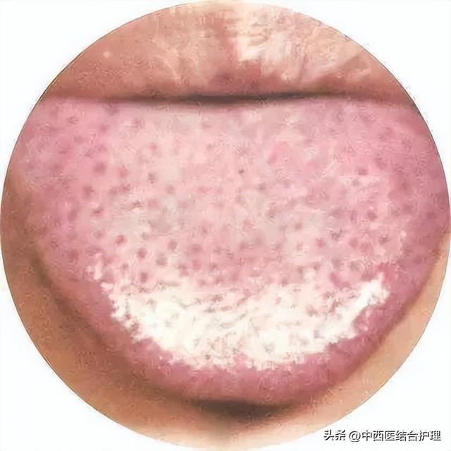 为什么很多人觉得舌尖3不如前两部好看了，舌尖3为什么评分那么低（舌头出现的各种症状）