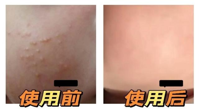 宝宝可以用润肤乳液吗，宝宝有必要涂润肤乳吗（儿科专家：宝宝润肤乳这样选）