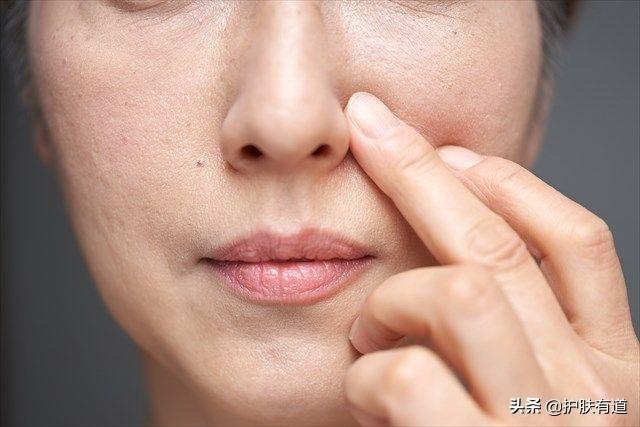 长暗疮怎么办，一直长暗疮怎么办（ 拆解8个暗疮部位）