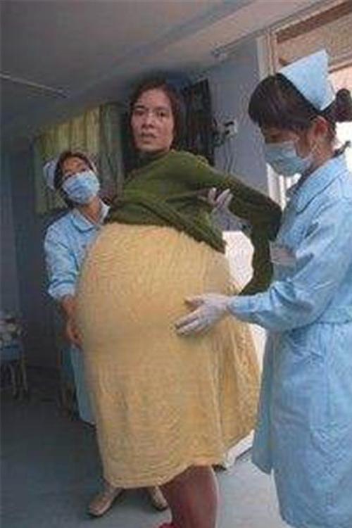 我的肚子是这样的，我的肚子是这样的作文（09年广东女子挺55公斤巨肚图片）