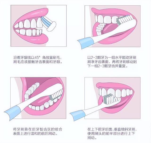 儿童正确刷牙方法，儿童正确刷牙方法图解卡通图片（两大常见儿童正确刷牙法步骤介绍）