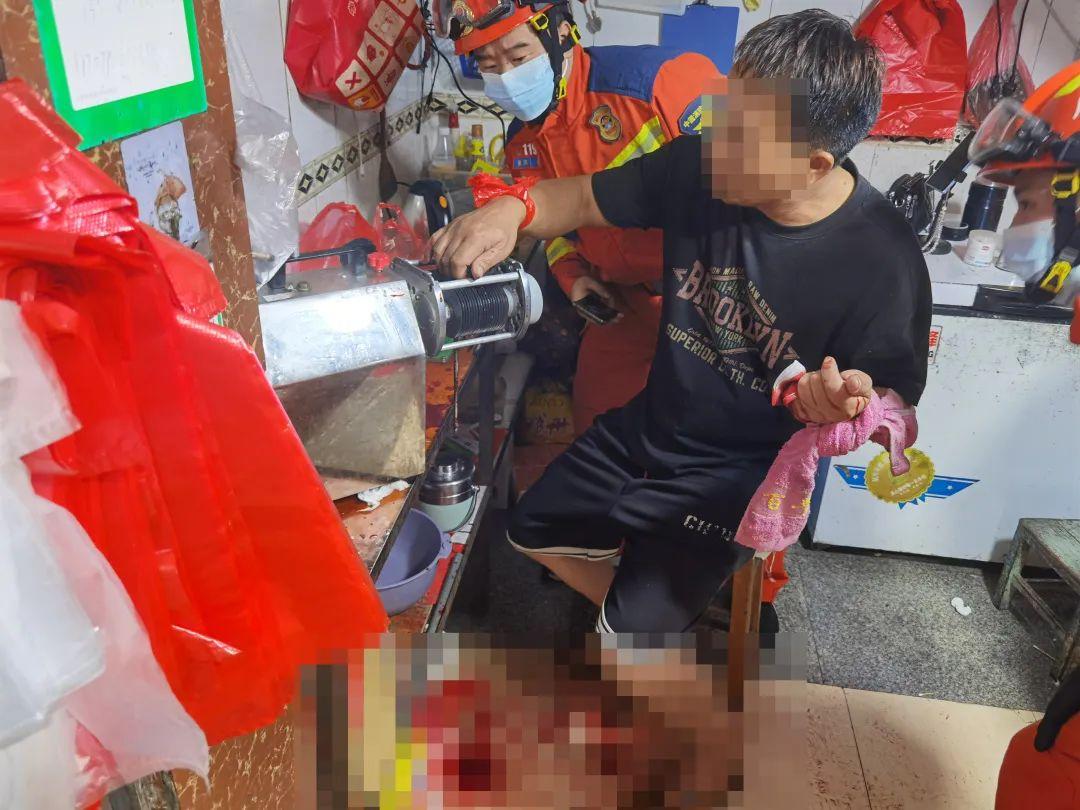 北海绞肉机家电维修 疼！疼！疼！群众手指被卡绞肉机，北海消防站接力救援