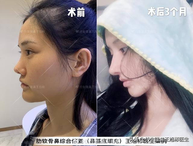 高级脸是什么意思，6种脸型不显老（“月亮脸”逆袭“高级脸”的不二法则是）