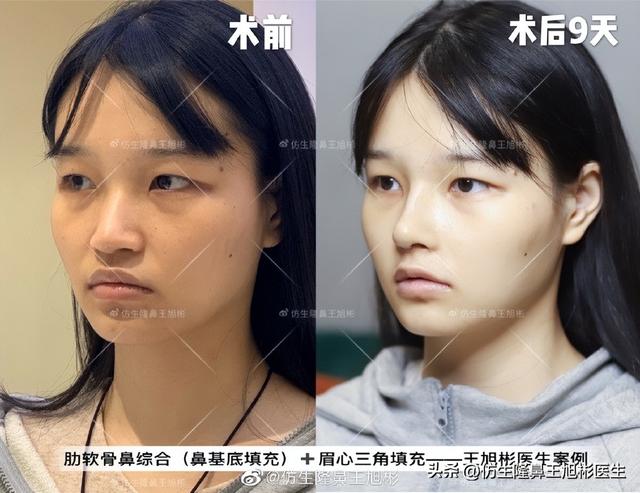 高级脸是什么意思，6种脸型不显老（“月亮脸”逆袭“高级脸”的不二法则是）